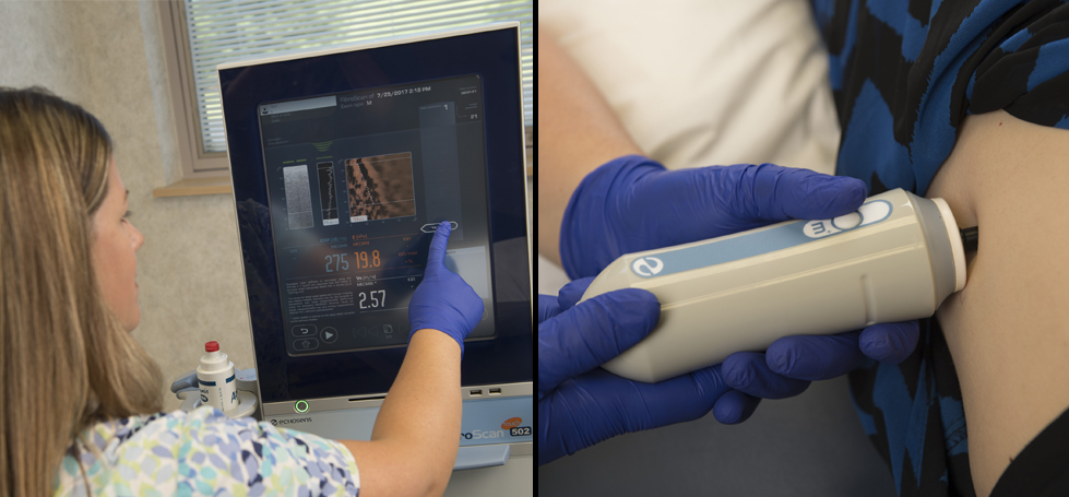 FibroScan®